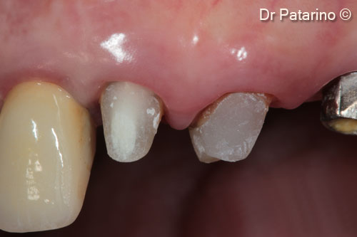 24 - Vestibular view