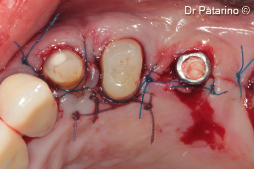 14 - Occlusal view