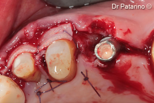 12 - Occlusal view