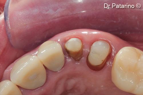 19 - Occlusal view