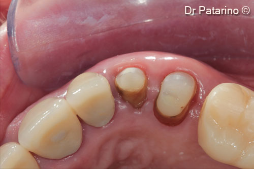 19 - Occlusal view
