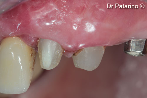16 - Vestibular view