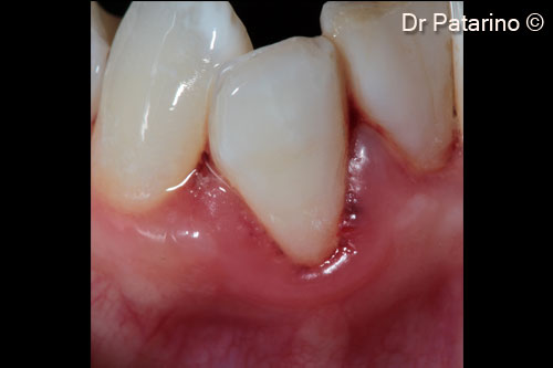 2 - Particular of the clinical situation of element 4.2