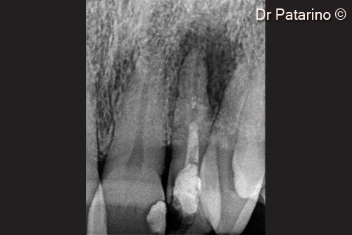 3 - Endoral x-ray 