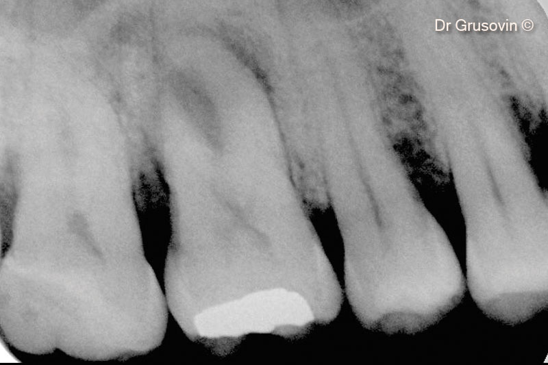 3. X-ray #16