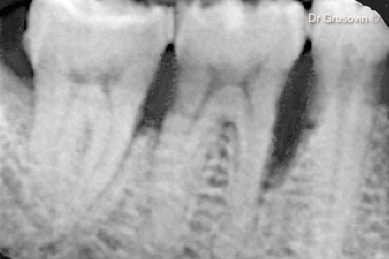 10. X-rays #46