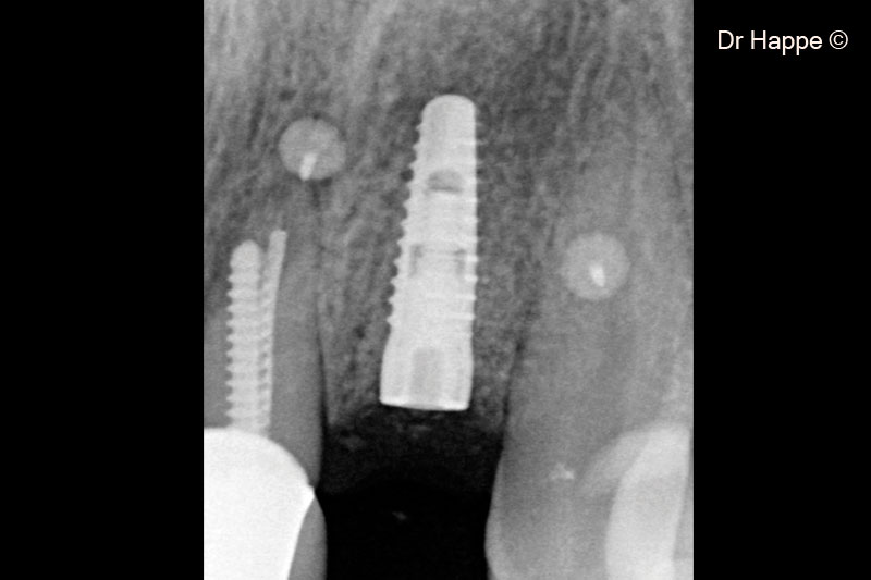 9. Postoperative x-ray