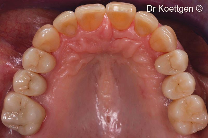 Complex functional, periodontal,...