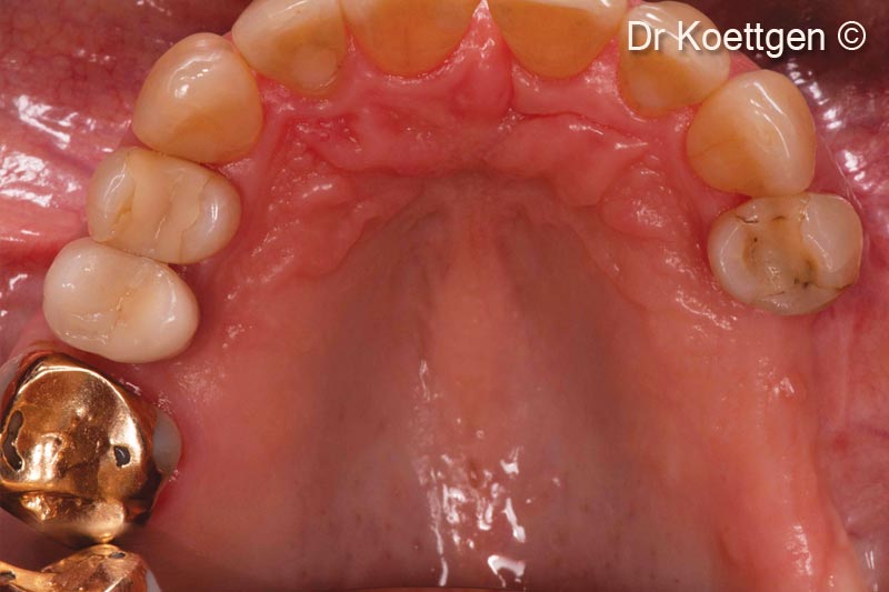 5. Occlusal view of situs