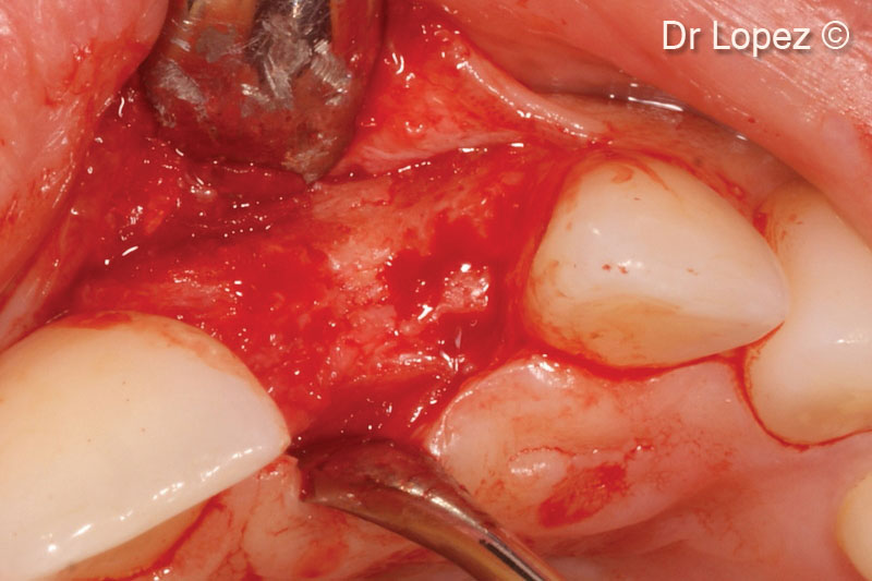 16. Intraoperative view