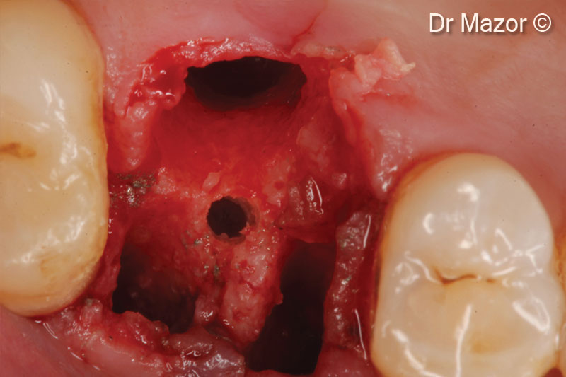8. Occlusal view