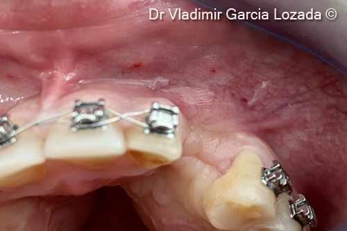 Fig. 1. Initial clinical situation