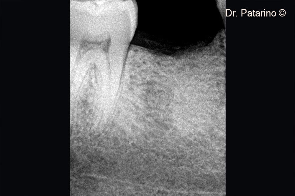 9. Rx after six months
