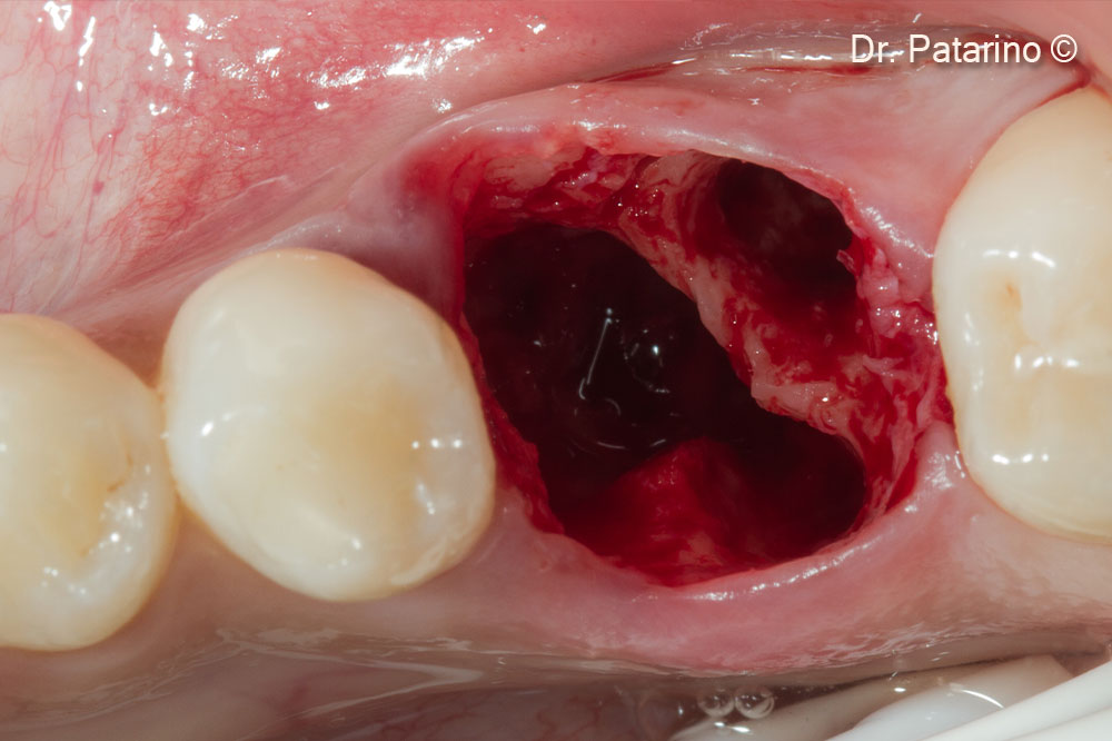 2. Pre-op clinical view