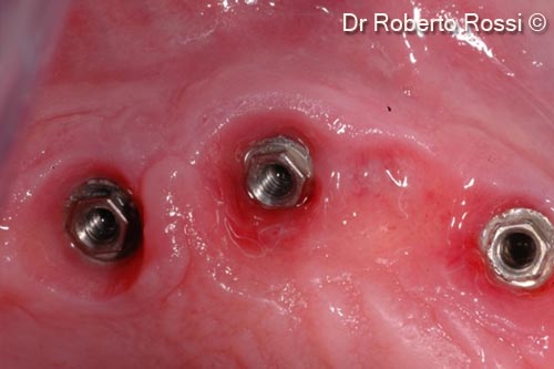 2. Soft tissues