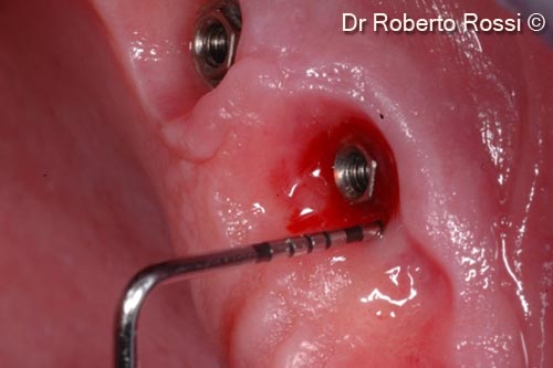 3. Probing