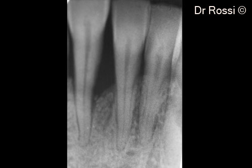 6. 36-months follow up