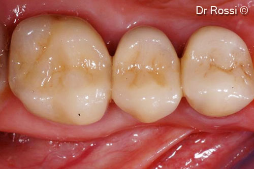 10. Palatal view