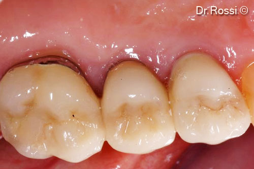 9. Occlusal view