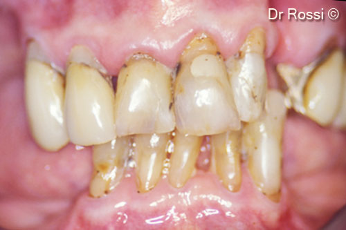 1. Initial intraoral image