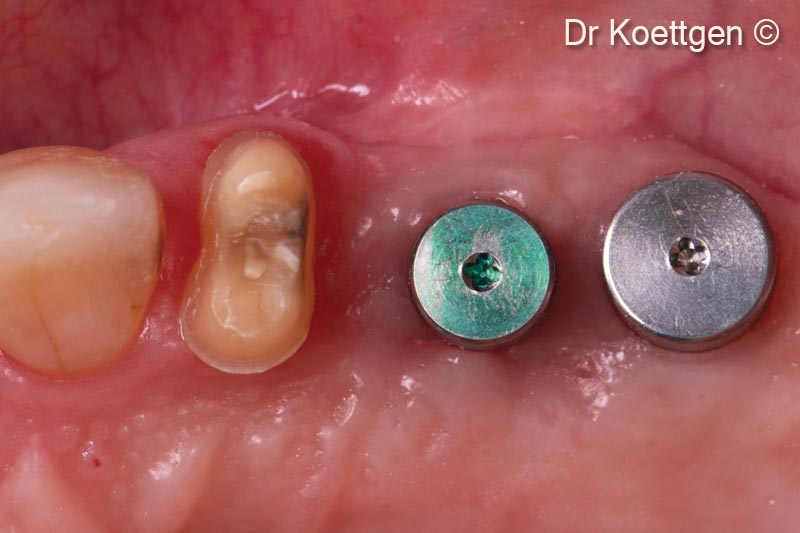 14. Healed situation