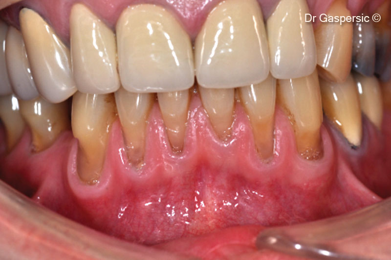 1. Initial condition