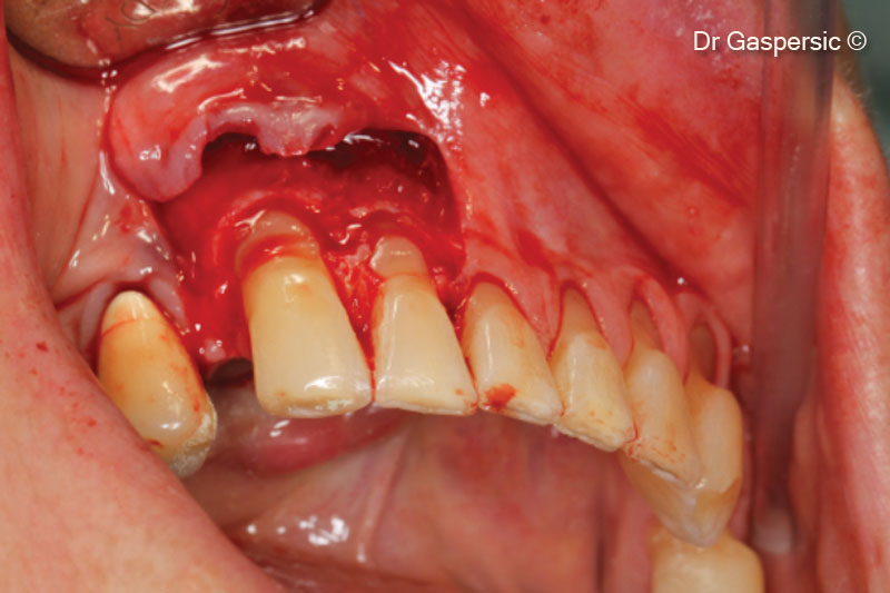 8. Occlusal view