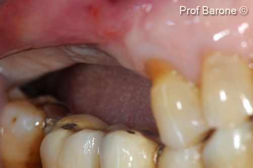 1. Pre-operative view