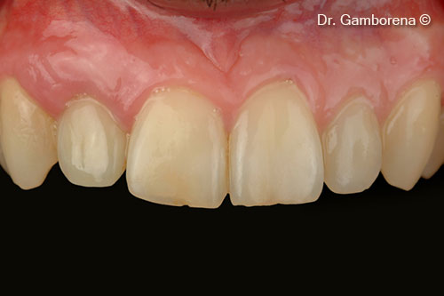26. Restoration after 4 years