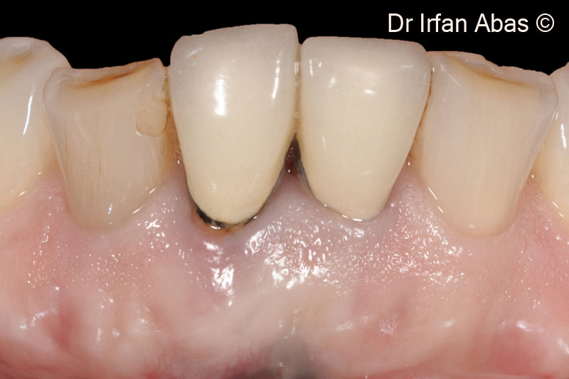 1. Initial situation