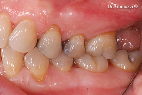 1. Initial clinical situation: 27 is missing