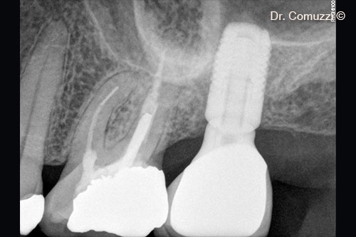 12. Follow-up at 3 years