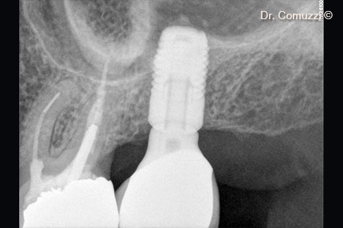 13. Follow-up at 4 years