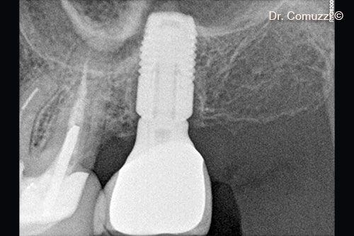 14. Follow-up at 12 years