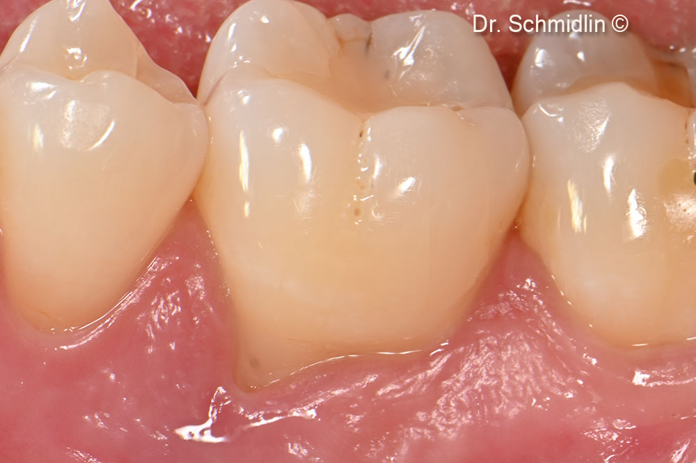 Preoperative clinical view of the affected site