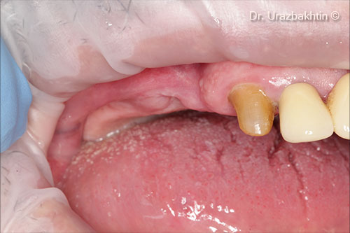Initial intraoral view