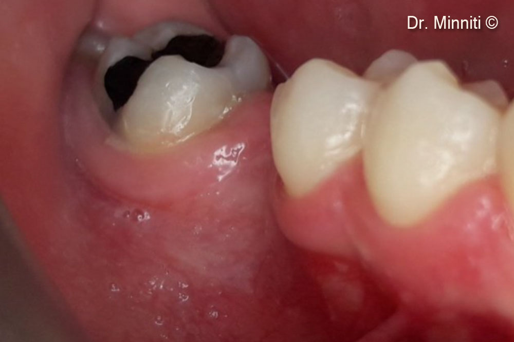 Pre-op clinical view - lateral view
