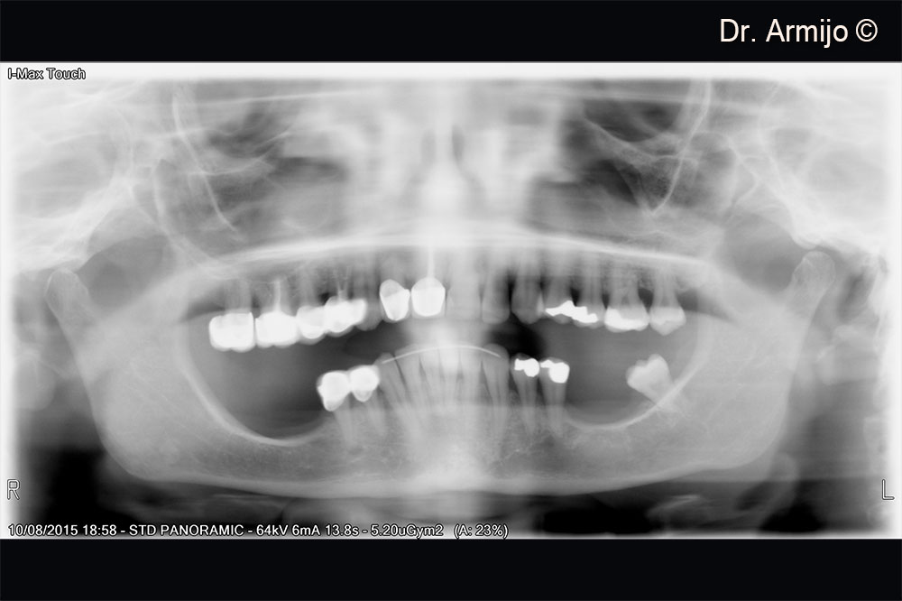 Initial orthopantomography