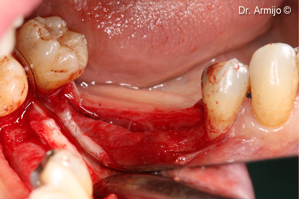 Clinical image at 8 months