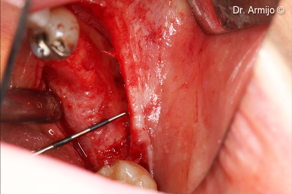 Clinical image at 8 months