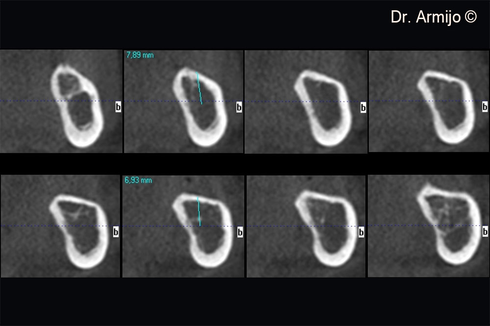 CT scan visualisation