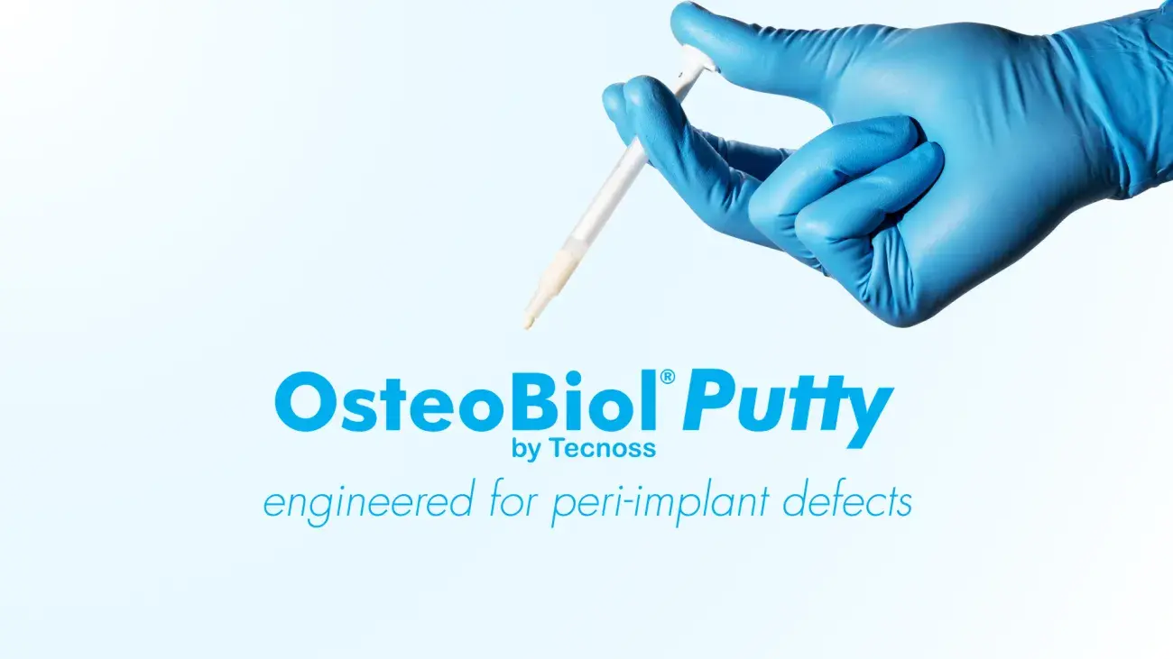 OsteoBiol Putty - Thumbnail video