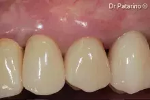 Implantpositioning_cover.jpg