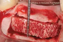 Interpositionalblockbone_cover.jpg