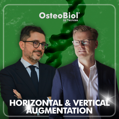 Horizontal and Vertical augmentation course 2026